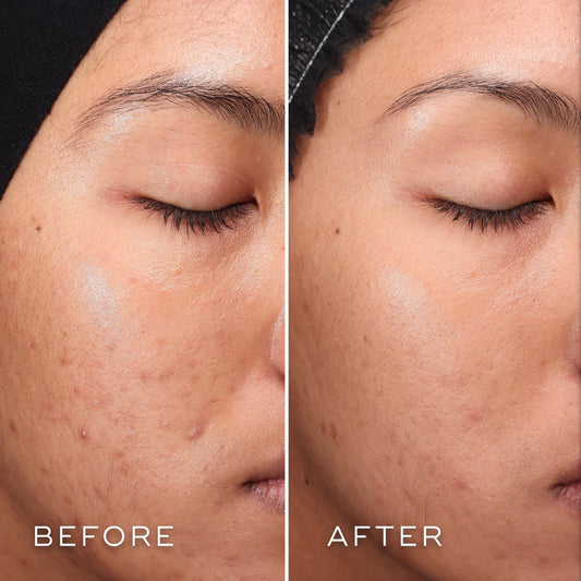 Press & Clear - Refill | Medik8